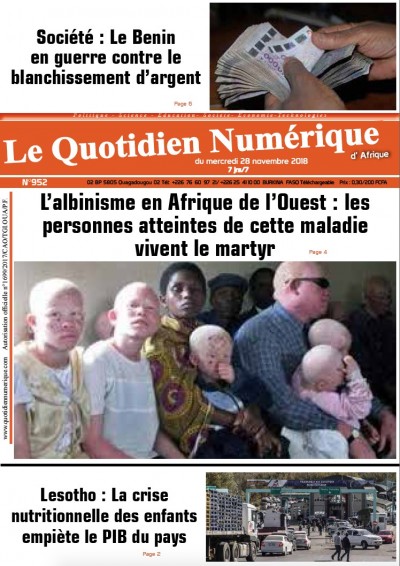 Jaquette L’albinisme en Afrique de l’Ouest